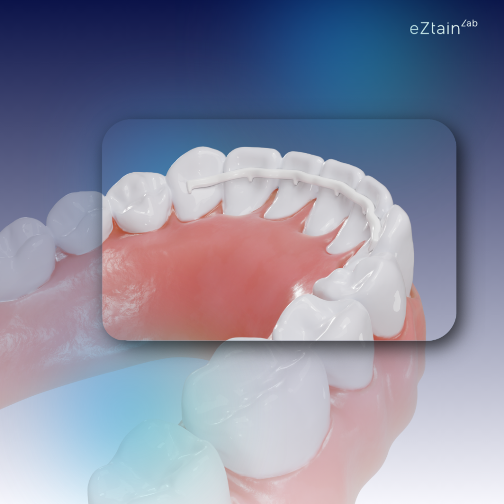 new generation of orthodontic retainer made of PEEK