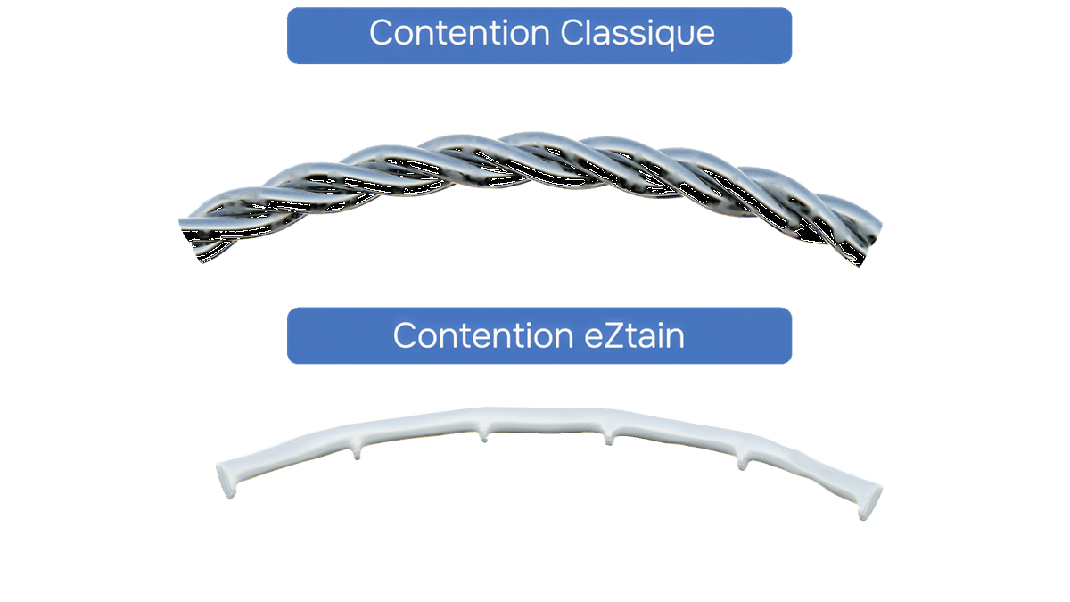 Comparatif du fil de contention : acier torsadé classique contre contention eZtain en PEEK lisse